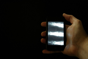 x ray