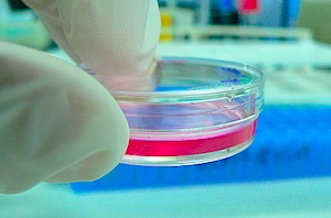 petri dish